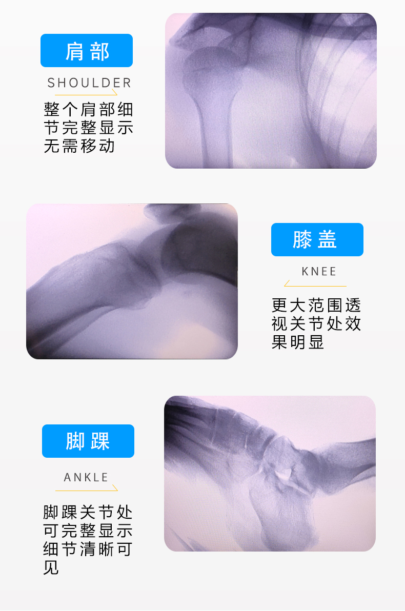 C200四肢透視儀詳情_07