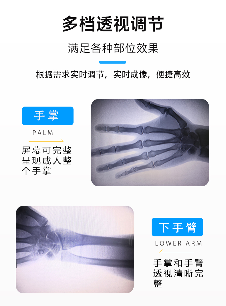 C200四肢透視儀詳情_06